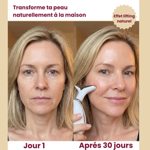 Sentoia™ — Sculpteur Lift Cou & Visage 7-en-1